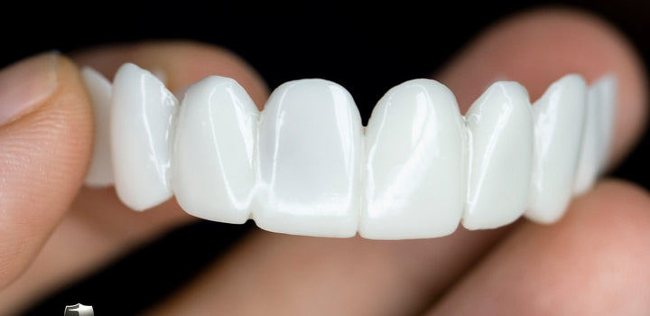 Lisslune | Dental prosthesis