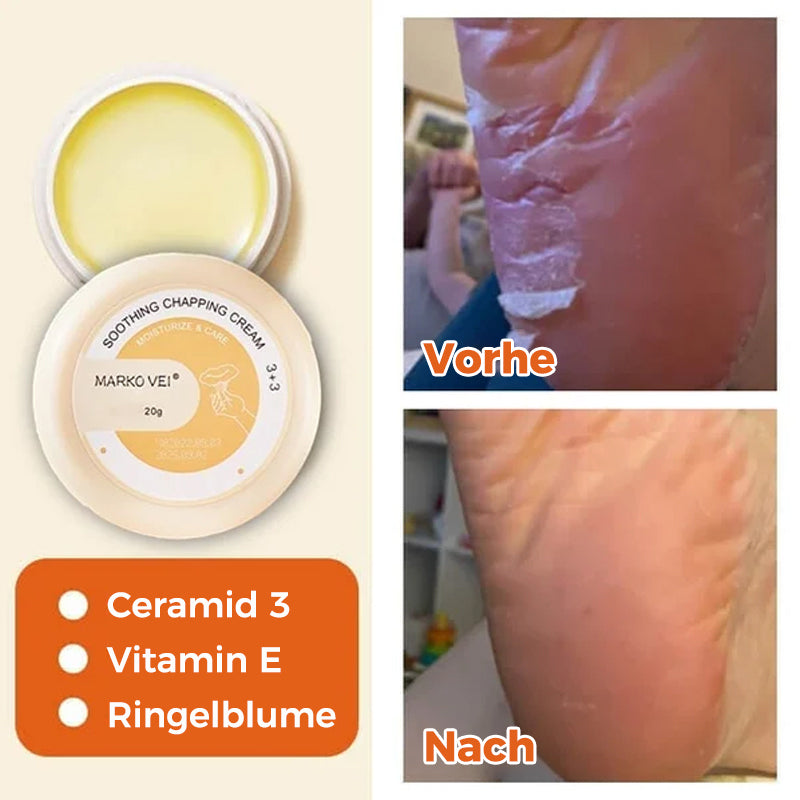 Lisslune | Tear-resistant cream for winter skin