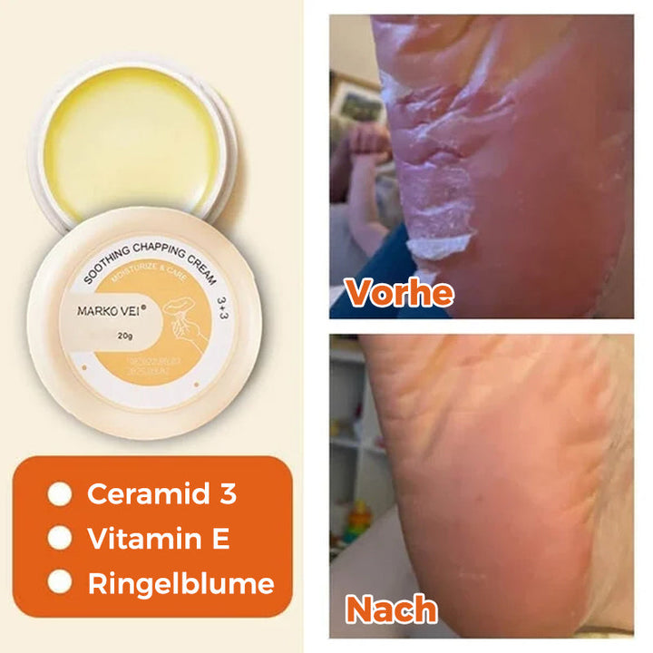 Lisslune | Tear-resistant cream for winter skin
