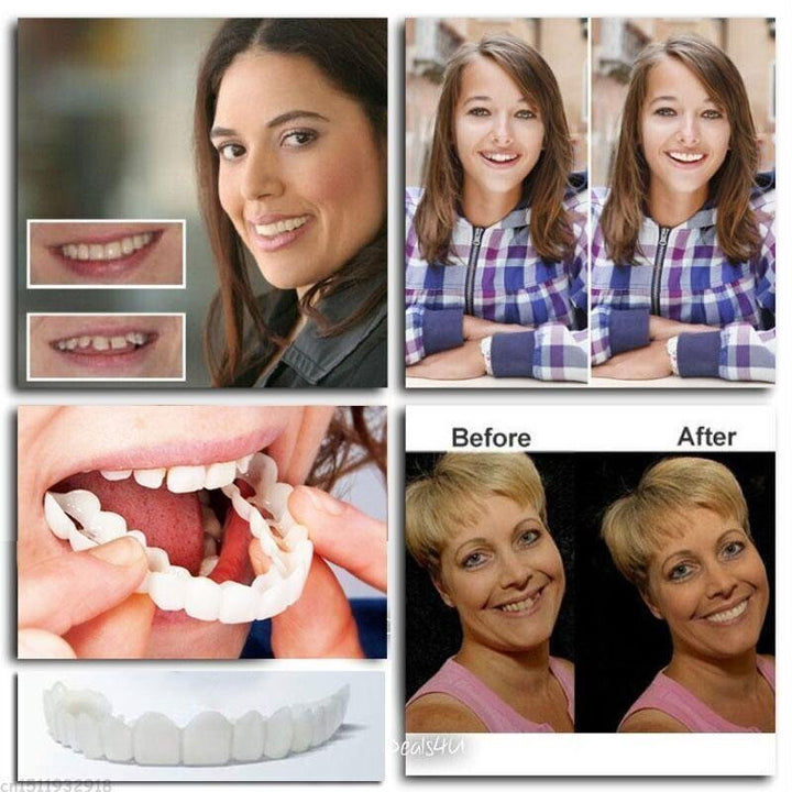 Lisslune | Adjustable Snap-On Dentures
