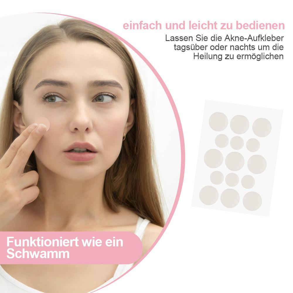 Lisslune | Acne Stickers, 30 pieces