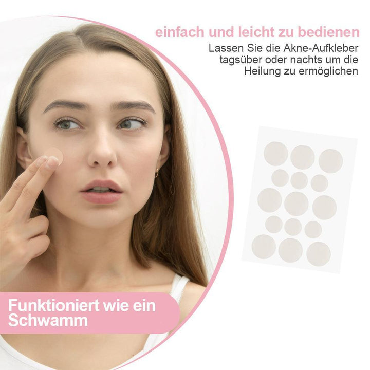 Lisslune | Acne Stickers, 30 pieces