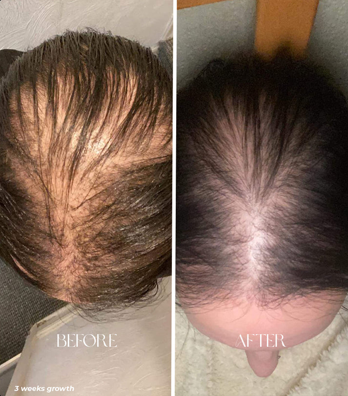Lisslune | Hair oil applicator bottle