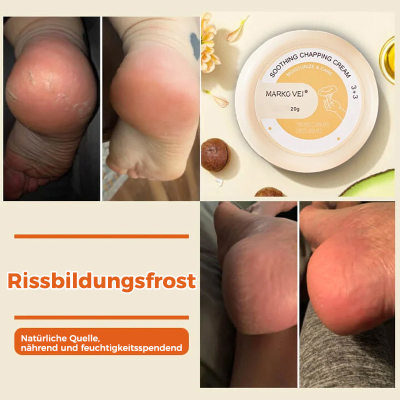 Lisslune | Tear-resistant cream for winter skin