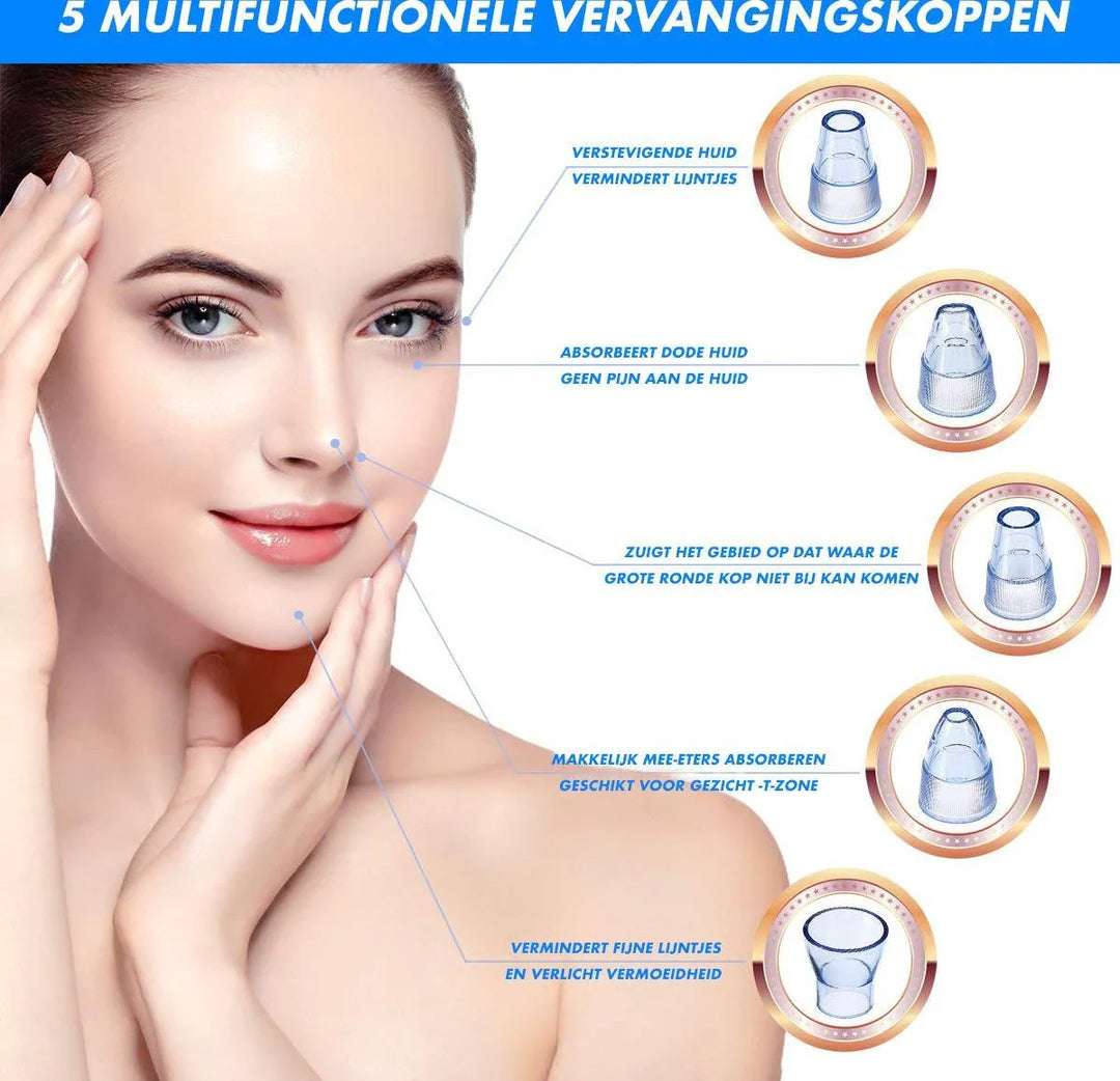 Lisslune | Electric Blackhead Remover