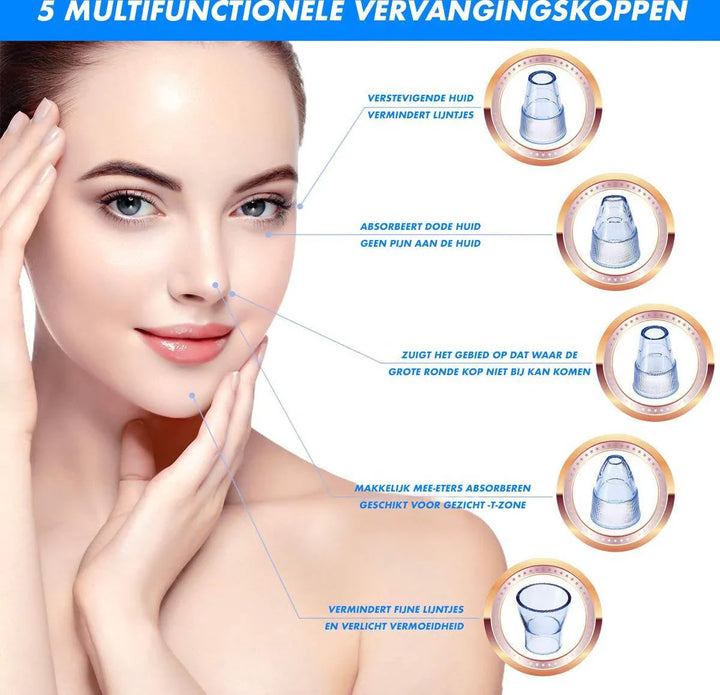 Lisslune | Electric Blackhead Remover