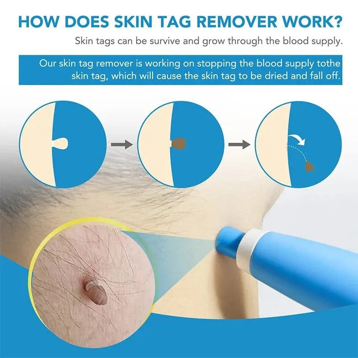 Lisslune | Hair Growth Remover Kit