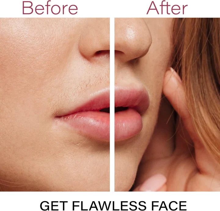 Lisslune | Perfect Facial Hair Remover