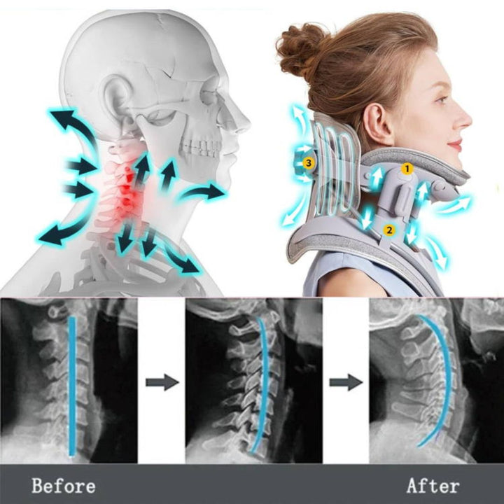 Lisslune | Neck Stretcher for Pain Relief - Adjustable Cervical Traction Device Ideal for Neck Tension and Discomfort