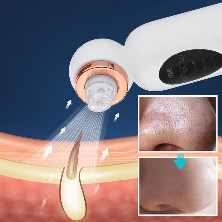 Lisslune | Blackhead Remover and Hydrodermabrasion Device