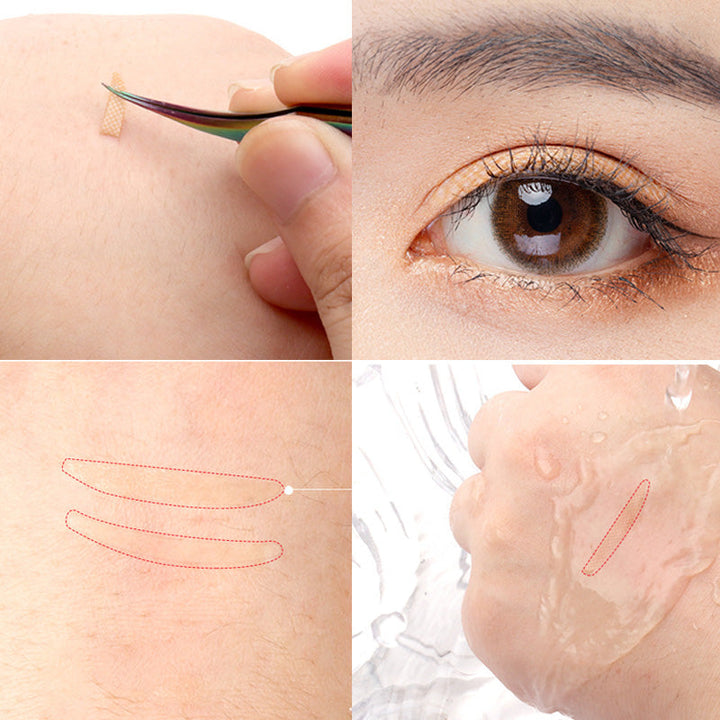 Lisslune | Eyelid Sagging Lids Stripes Sagging Lid Double Lids