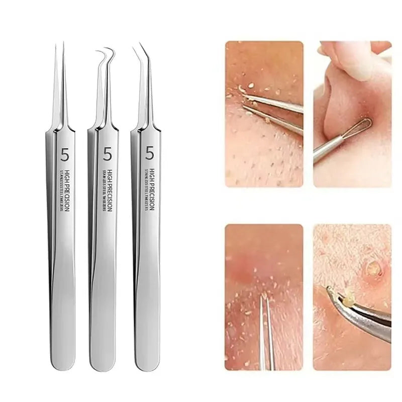 Lisslune | Tweezer for Removing Blackheads on the Face