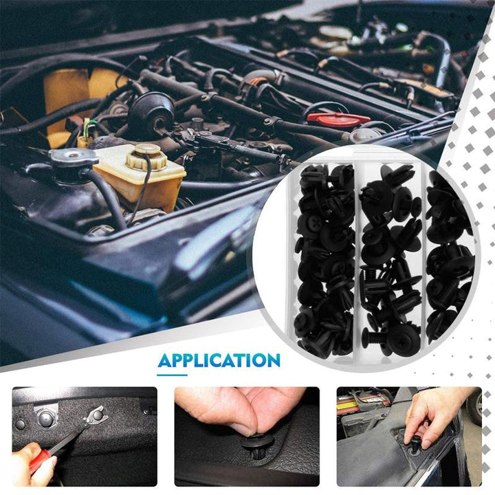 Lisslune | Universal Car Plastic Fender Fastening Clips (150 Pieces)