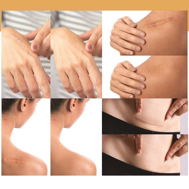Lisslune | Skin Invisible Concealer Patch