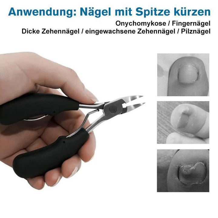 Lisslune | 304 Stainless Steel Nail Clipper Set, Prevention of Paronychia, Fungal Infection