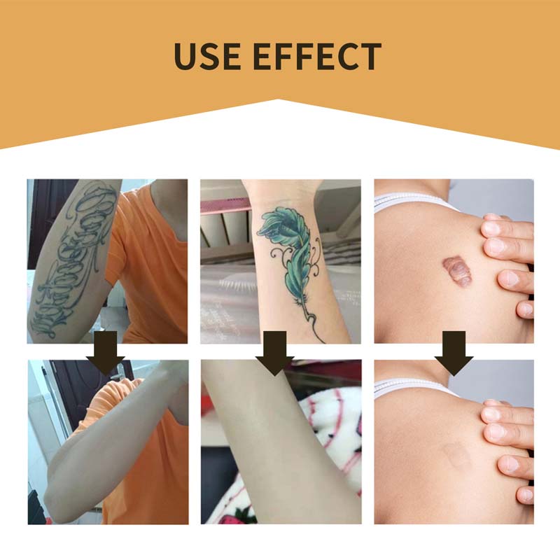Lisslune | Skin Invisible Concealer Patch
