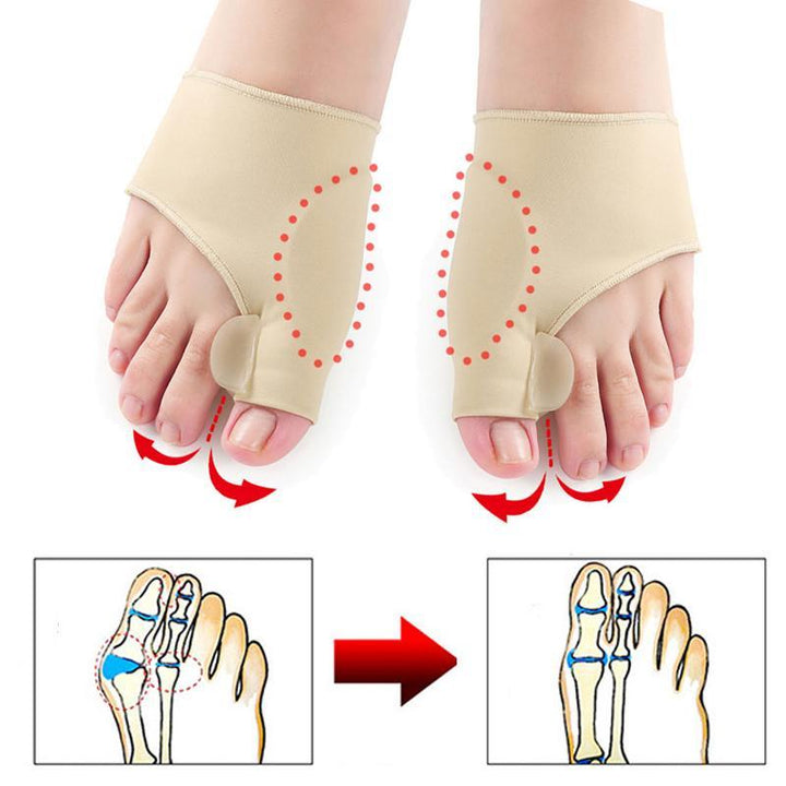 Lisslune | Bunion Orthopedic Corrector Sleeve