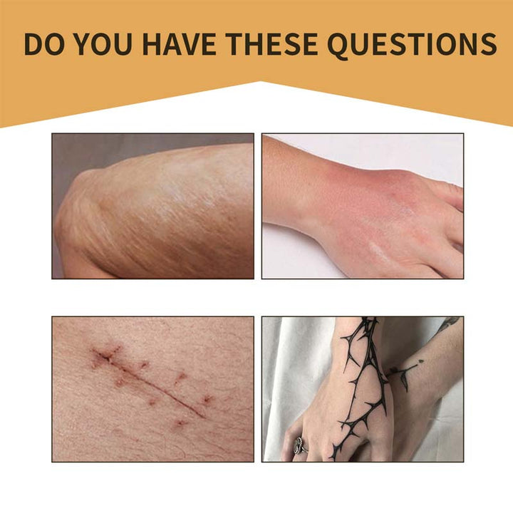 Lisslune | Skin Invisible Concealer Patch