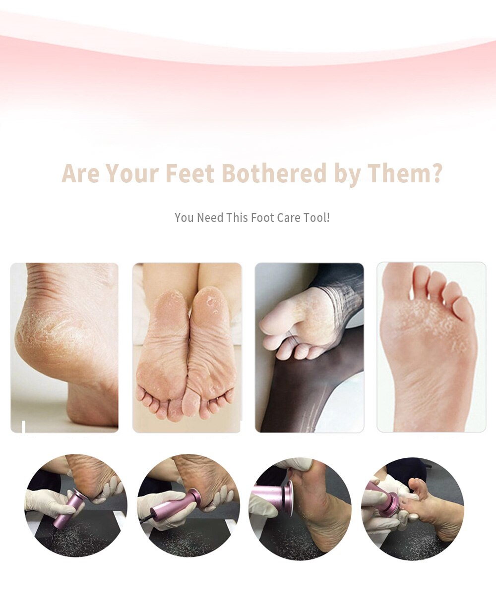 Lisslune | Callus Remover - Foot Callus Remover