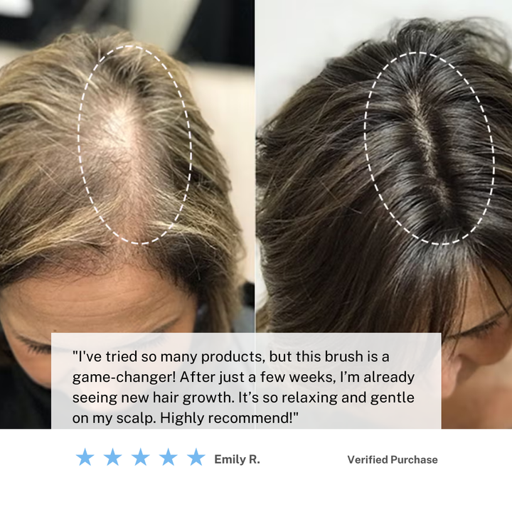 Lisslune | Cordless Scalp Massaging Brush – Boost Hair Growth & Relax at Home