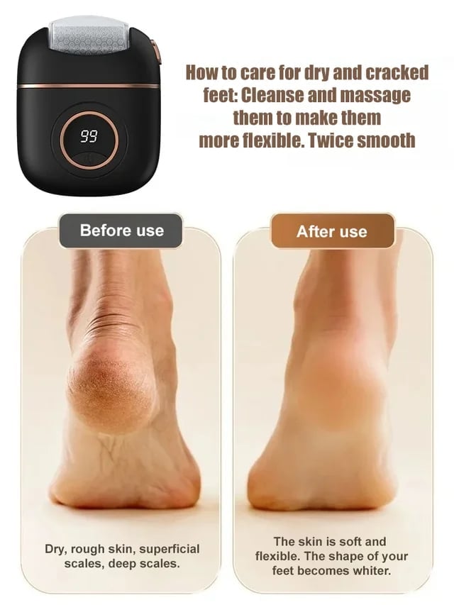 Lisslune | 2025 New digital electric foot polishing machine