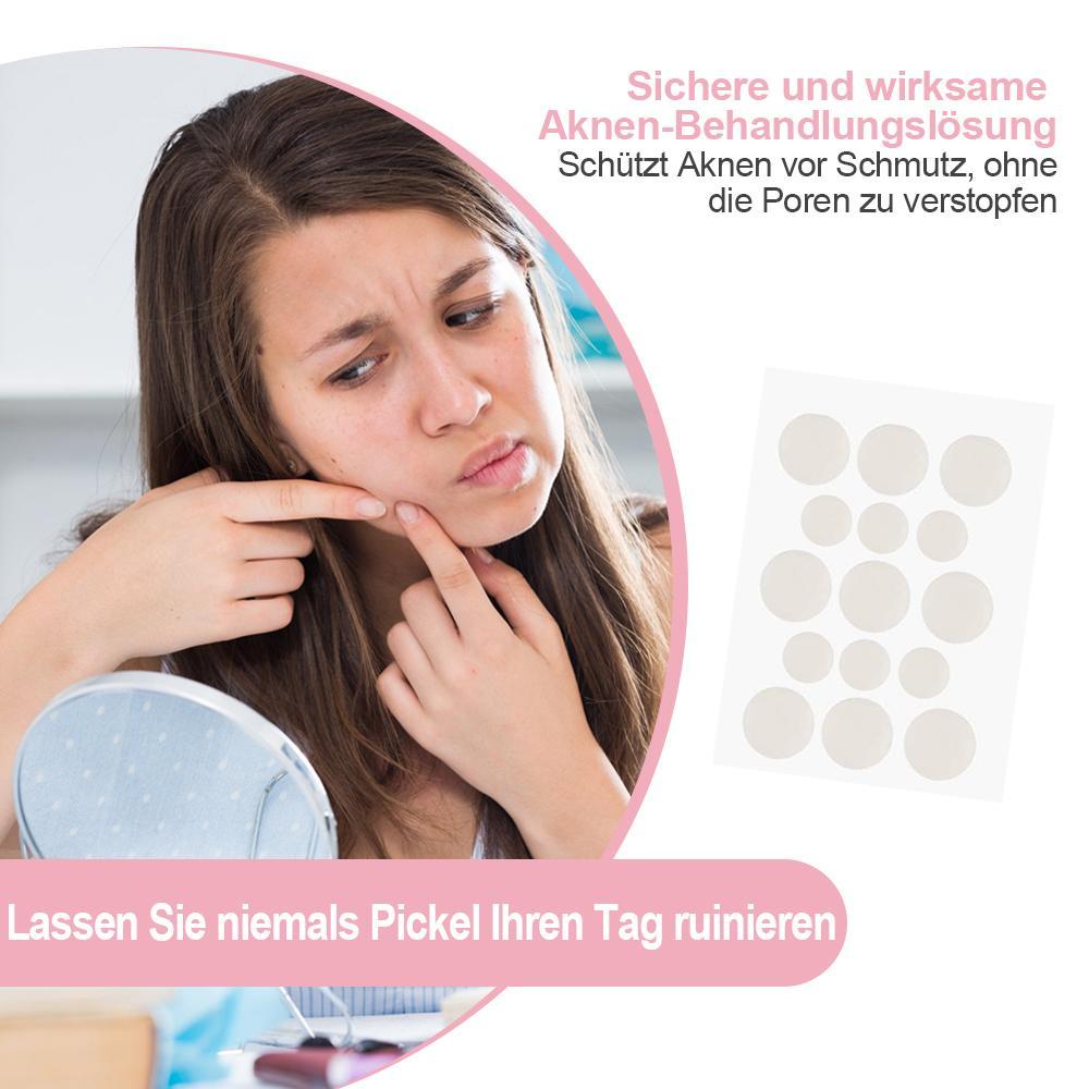 Lisslune | Acne Stickers, 30 pieces