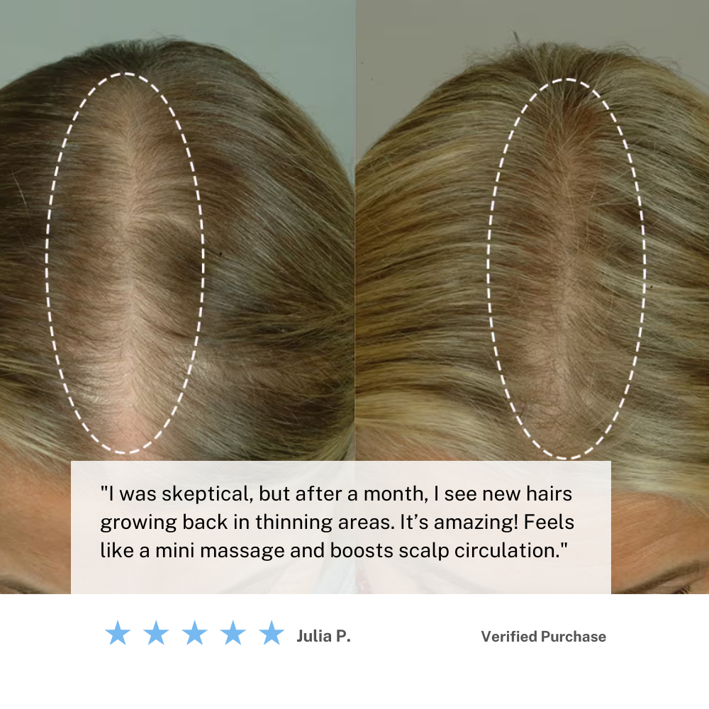 Lisslune | Cordless Scalp Massaging Brush – Boost Hair Growth & Relax at Home