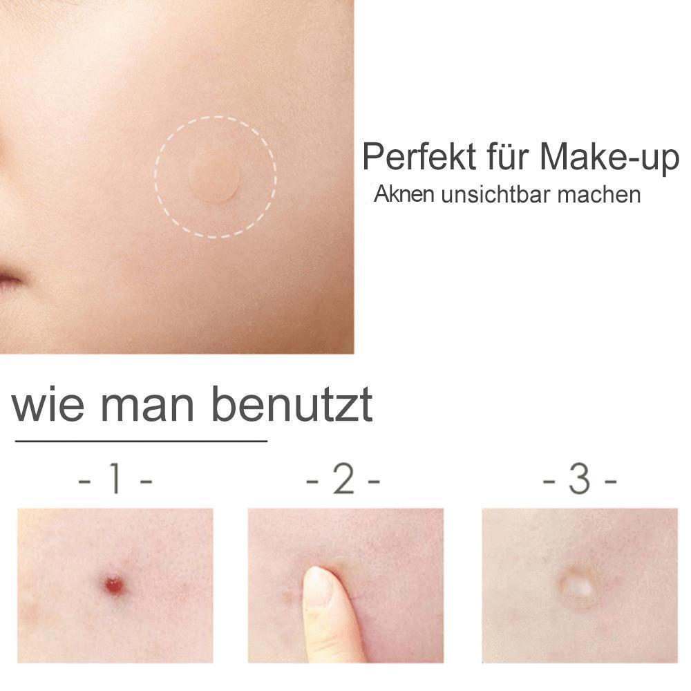 Lisslune | Acne Stickers, 30 pieces