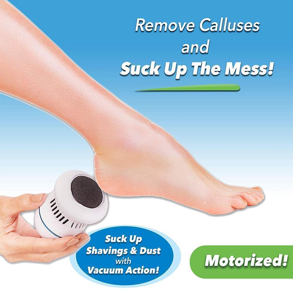 Lisslune | FootFile and Callus Remover