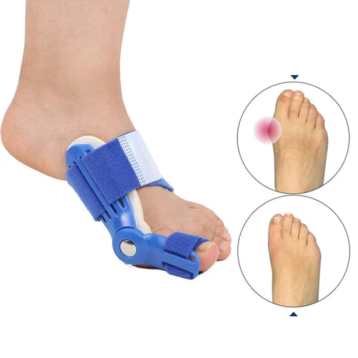 Lisslune | Hallux Valgus correction splint (1 pair)