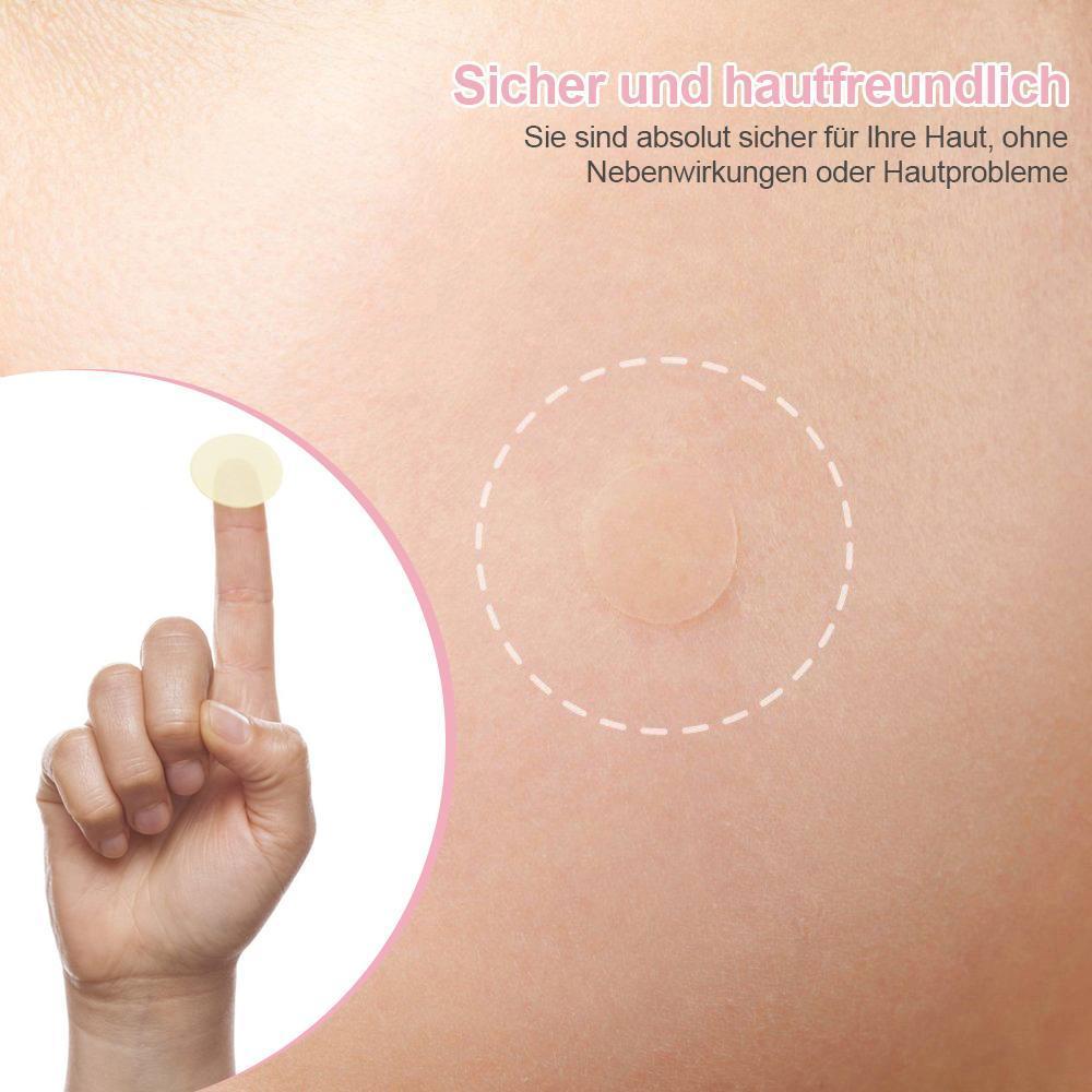 Lisslune | Acne Stickers, 30 pieces