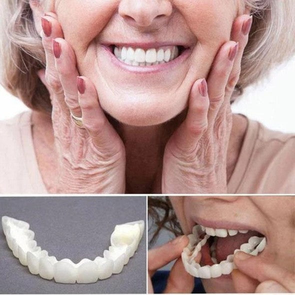 Lisslune | On Smile Veneers (Upper and Lower Jaw included)