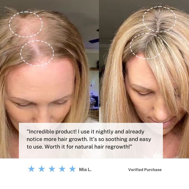 Lisslune | Cordless Scalp Massaging Brush – Boost Hair Growth & Relax at Home