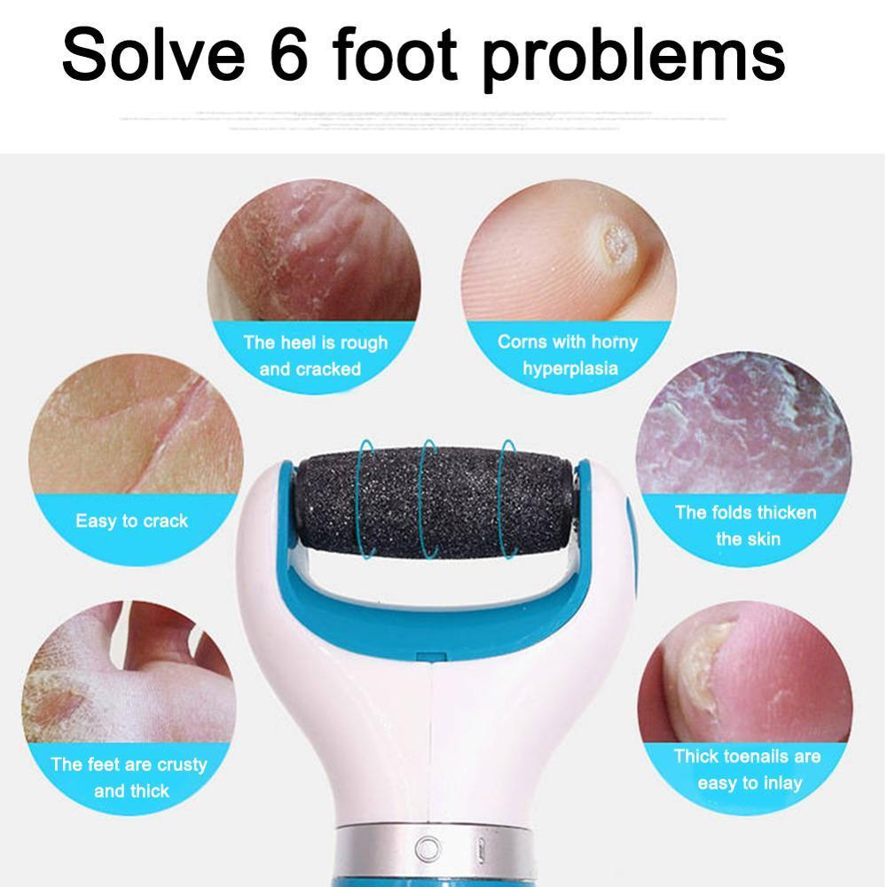 Lisslune | Callus Remover Foot Grinder Pedicure