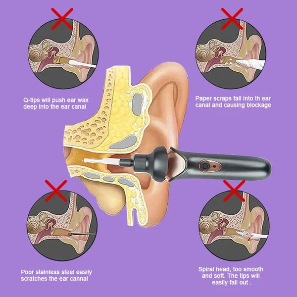 Lisslune | Painless Ear Wax Removal Kit – Safe & Effective Cleaning for the Whole Family