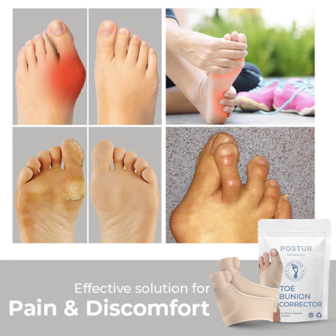 Lisslune | Hallux Valgus Corrector 2.0 – corrective support – pain relief – comfortable – wall clock