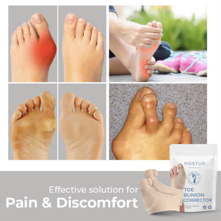 Lisslune | Hallux Valgus Corrector 2.0 – corrective support – pain relief – comfortable – wall clock