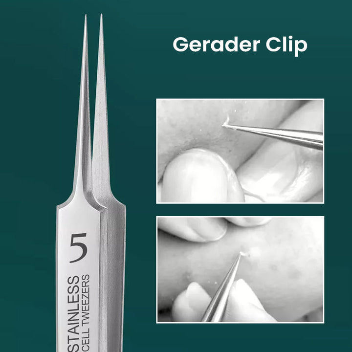 Lisslune | Professional High-Precision Clip for Removing Blackheads