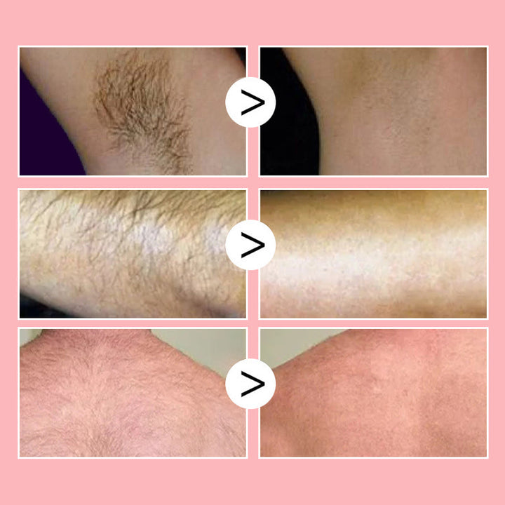 Lisslune | Honey Mousse Hair Removal Spray