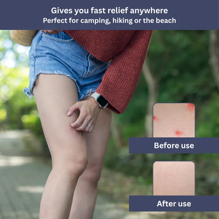 Lisslune | InstaRelief Sting Healer | Fast-Acting, Natural Formula for Insect Bites & Skin Irritations
