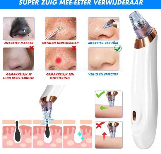 Lisslune | Electric Blackhead Remover
