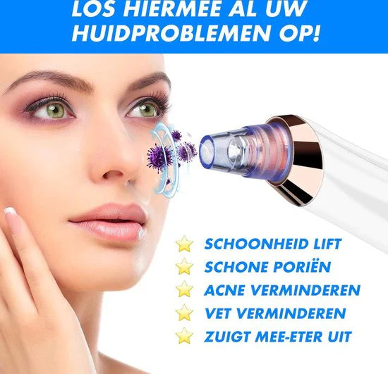 Lisslune | Electric Blackhead Remover