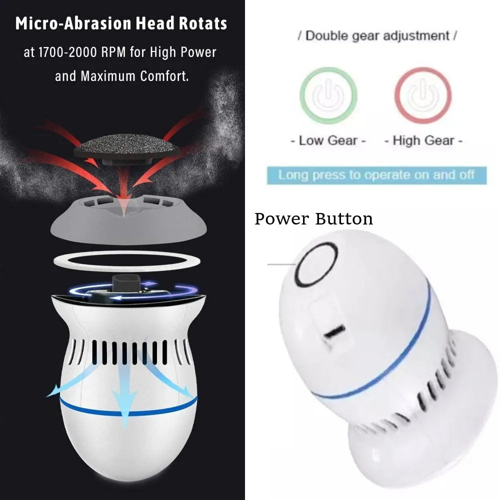 Lisslune | Vacuum Callus Remover