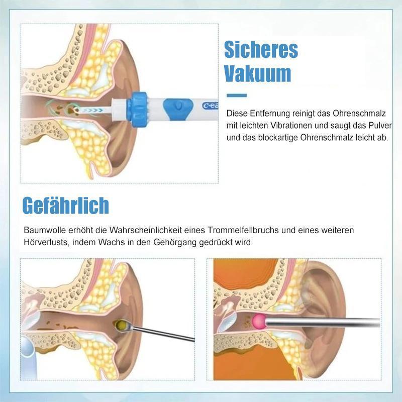 Lisslune | Earwax remover vacuum
