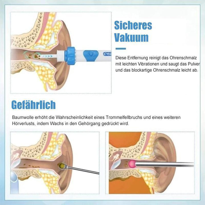 Lisslune | Earwax remover vacuum