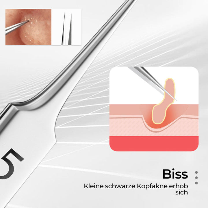 Lisslune | Tweezer for Removing Blackheads on the Face
