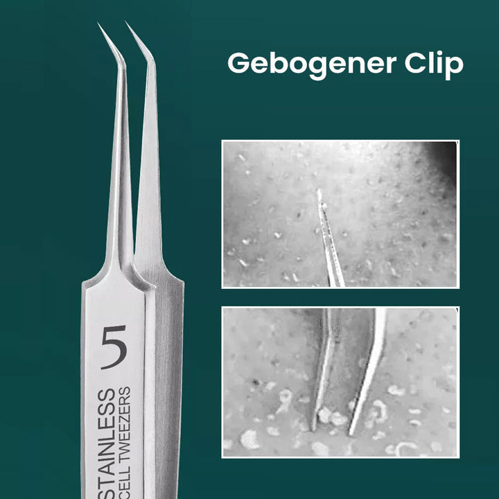 Lisslune | Professional High-Precision Clip for Removing Blackheads