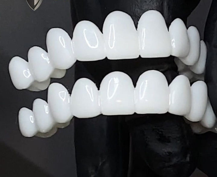 Lisslune | Dental prosthesis