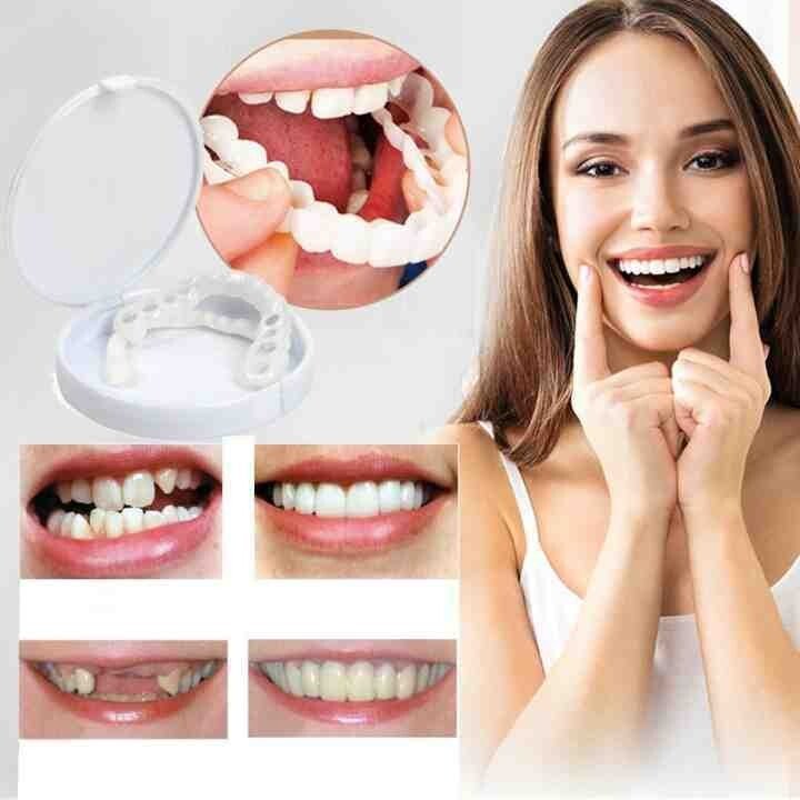 Lisslune | Adjustable Snap-On Dentures