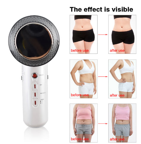 Lisslune | Ultrasound Massage Device